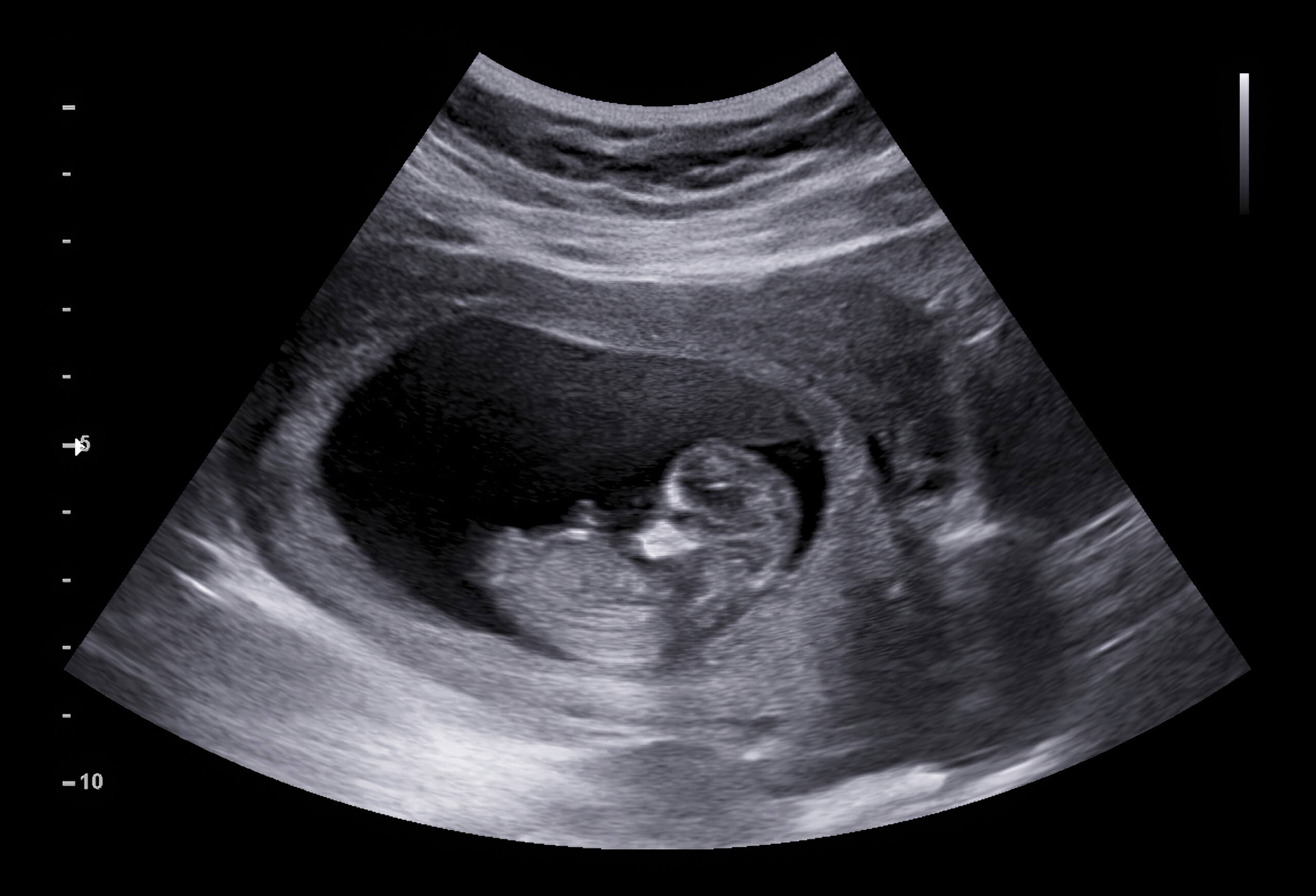 Ultrasound Equipment